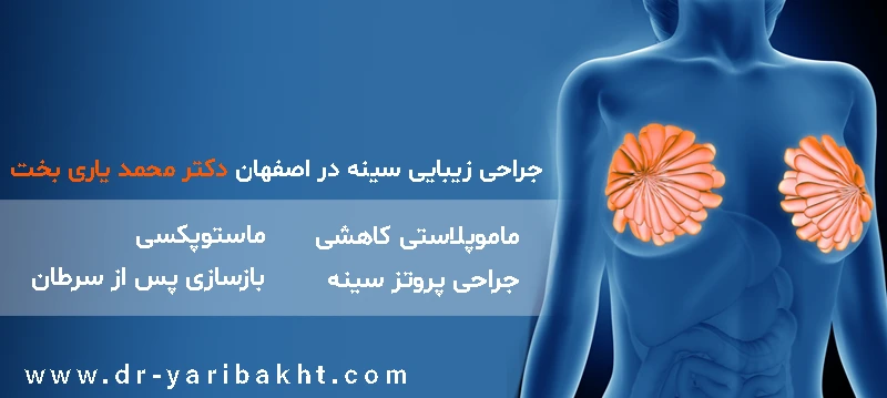 جراحی زیبایی سینه در اصفهان