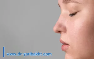 عمل بینی ترمیمی اصفهان