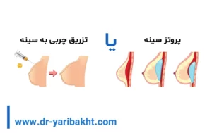پروتز سینه یا تزریق چربی به سینه
